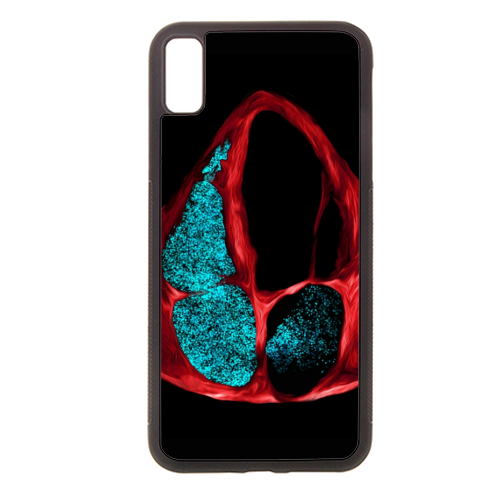 Heart - Bubbles PFO - stylish phone case by Echo Art