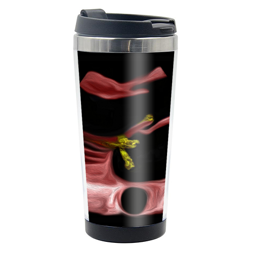 Heart - Infective Endocarditis - photo water bottle by Echo Art